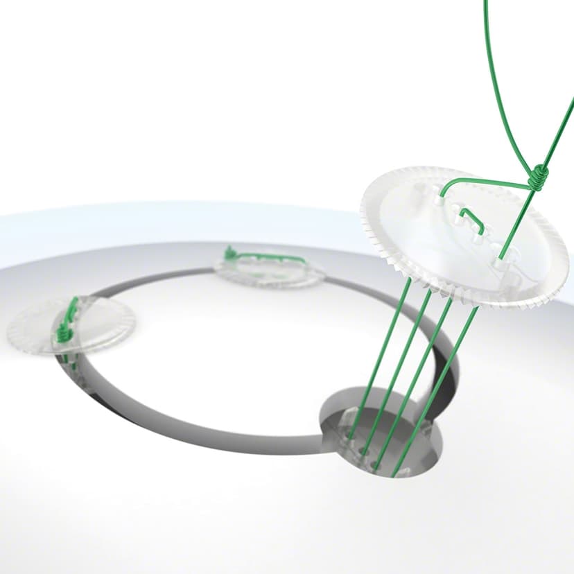 CranioFix® resorbierbar-Produktbild Vergrößerung CW