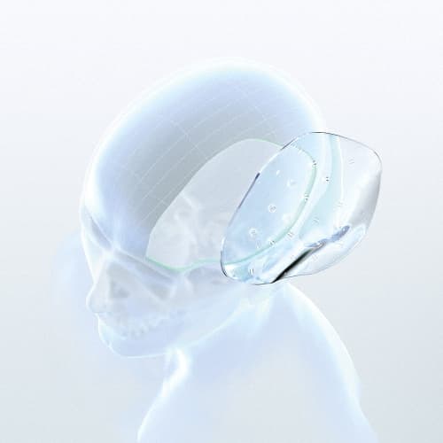 Patientenspezifische Implantate-Produktbild Vergrößerung CW