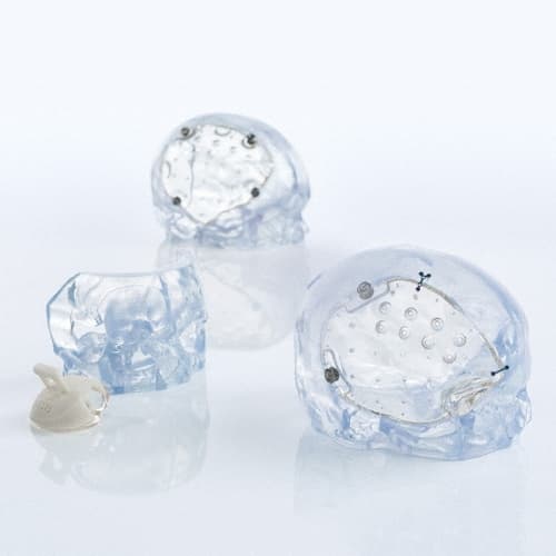 Patientenspezifische Implantate-Produktbild Vergrößerung CW