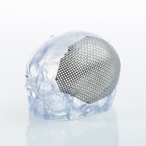 Patientenspezifische Implantate-Produktbild Vergrößerung CW